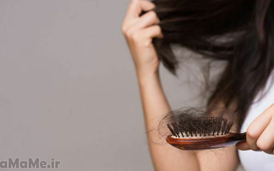 ریزش مو بعد از زایمان + نکات درمانی