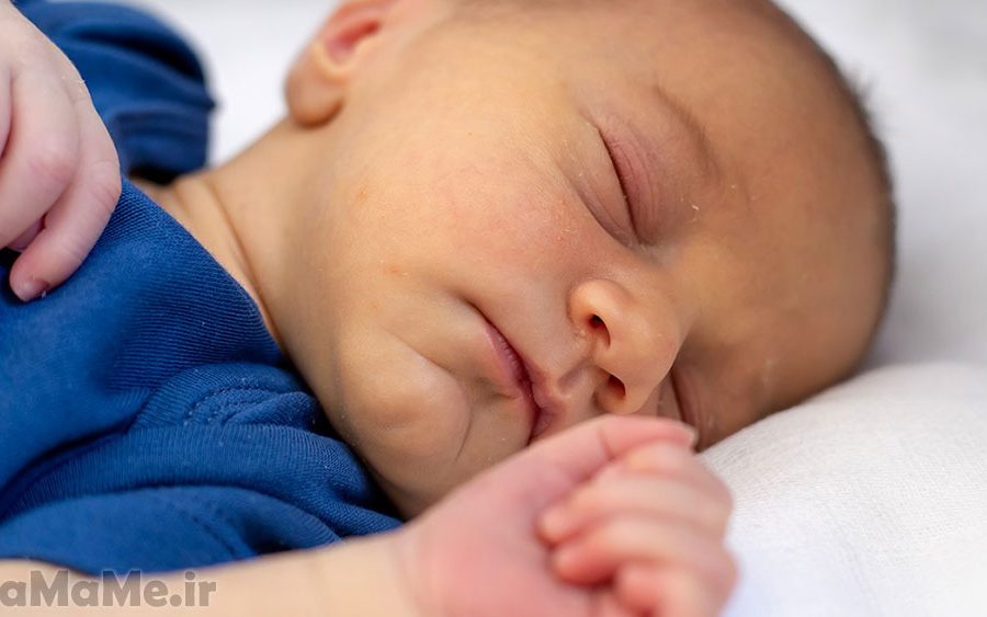 آیا زردی نوزاد باعث خواب آلودگی میشود؟ آیا زردی نوزاد برگشت پذیر است؟